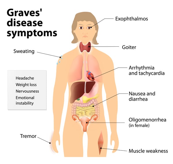 Graves Disease Symptoms OneGRAVESvoice